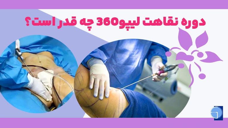 lipomatic 360 treatment duration